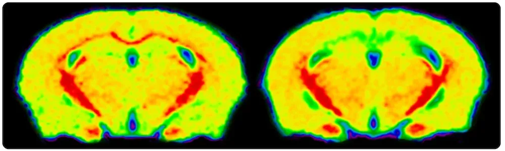 Two MRI brain scans in false color from a cuprizone mouse model, used to study demyelination related to Multiple Sclerosis (MS), highlighting areas of varying signal intensity that may represent tissue changes due to demyelination