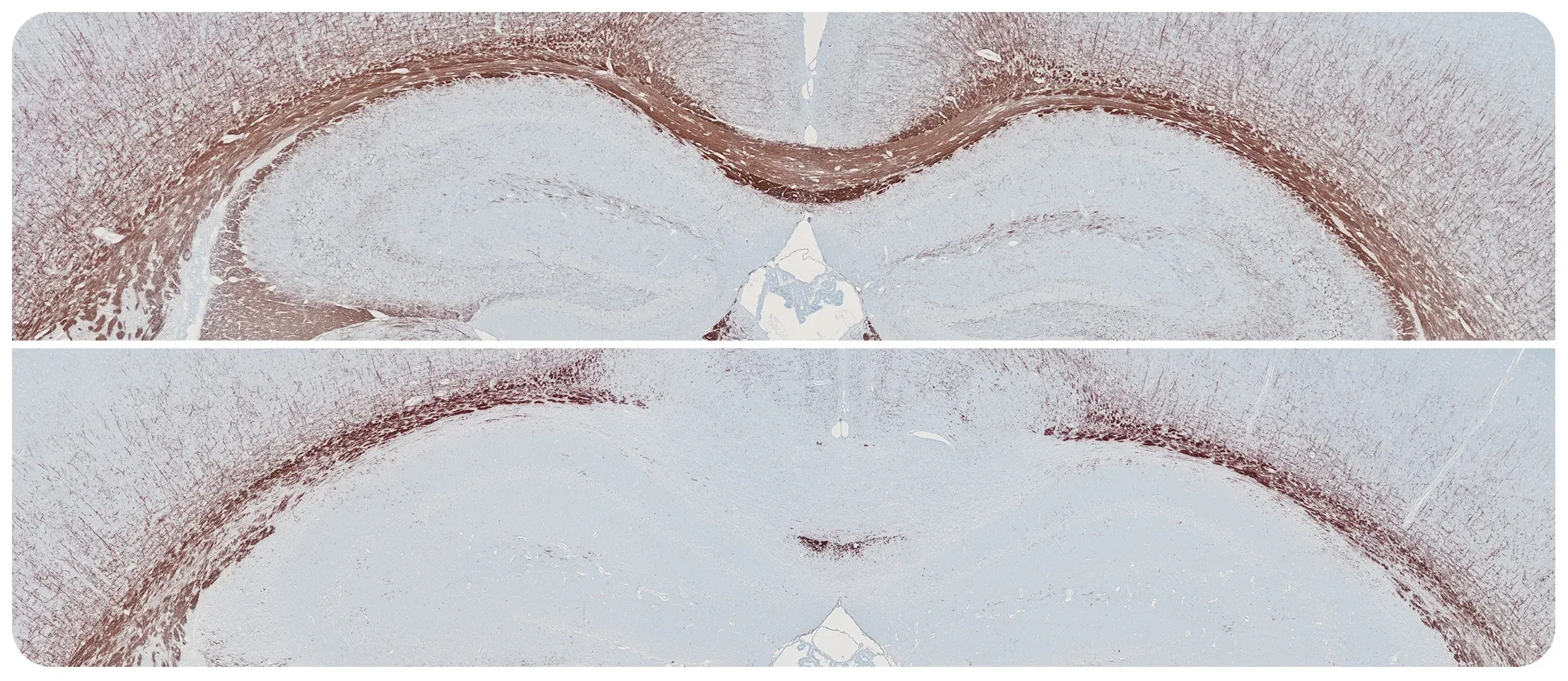 Deux coupes transversales de cerveau colorées pour la MBP, utilisée pour étudier la démyélinisation dans un modèle de souris cuprizone de la SP, avec différents niveaux de myéline indiqués par l'intensité de la coloration.