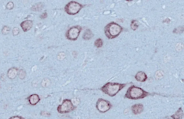 Low magnification view of human pan-TDP-43 pathology in the spinal cord