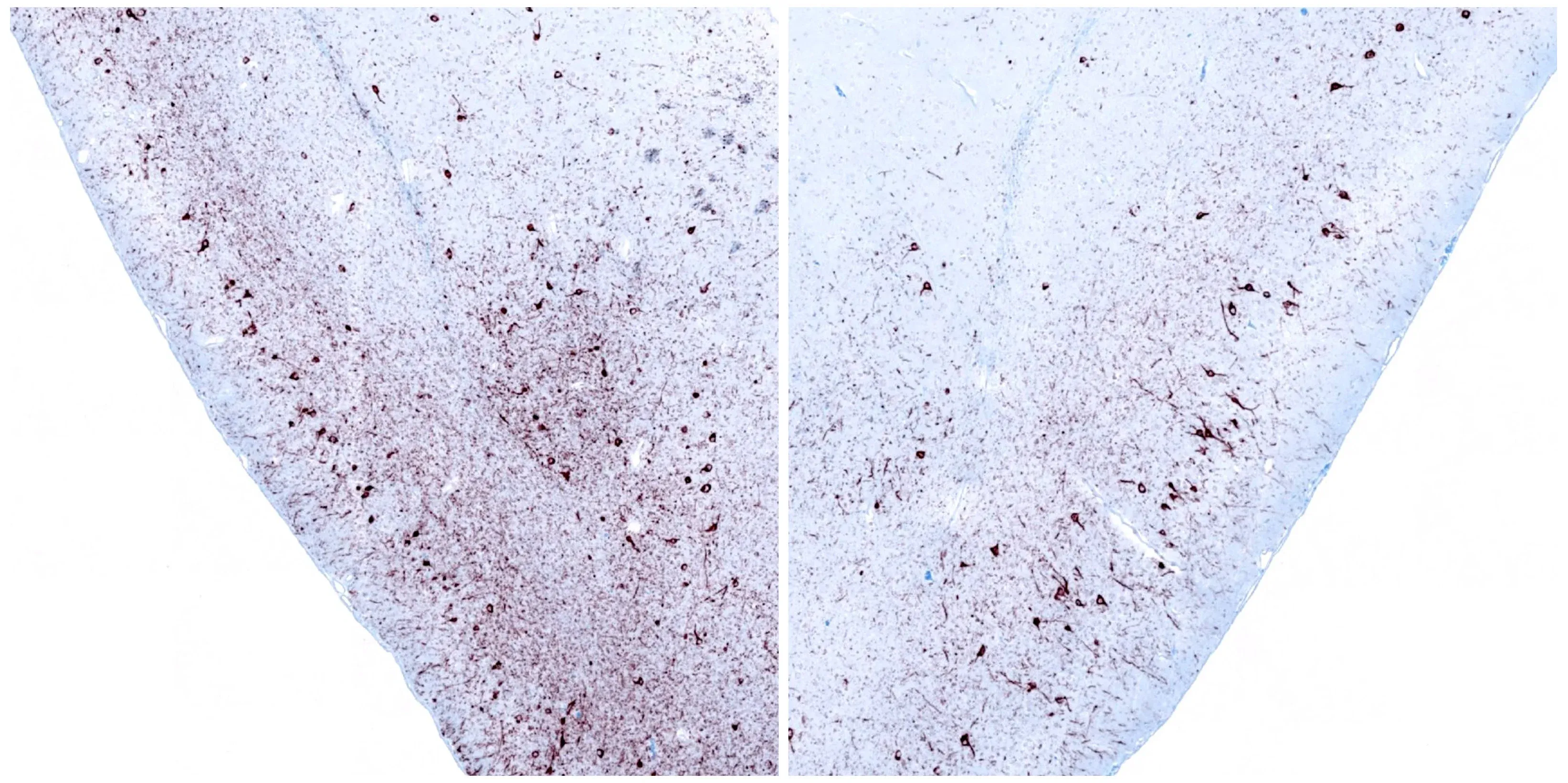 A pair of brain tissue sections processed with immunohistochemistry (IHC) to highlight phosphorylated alpha-synuclein, which is relevant in the context of Parkinson's Disease research