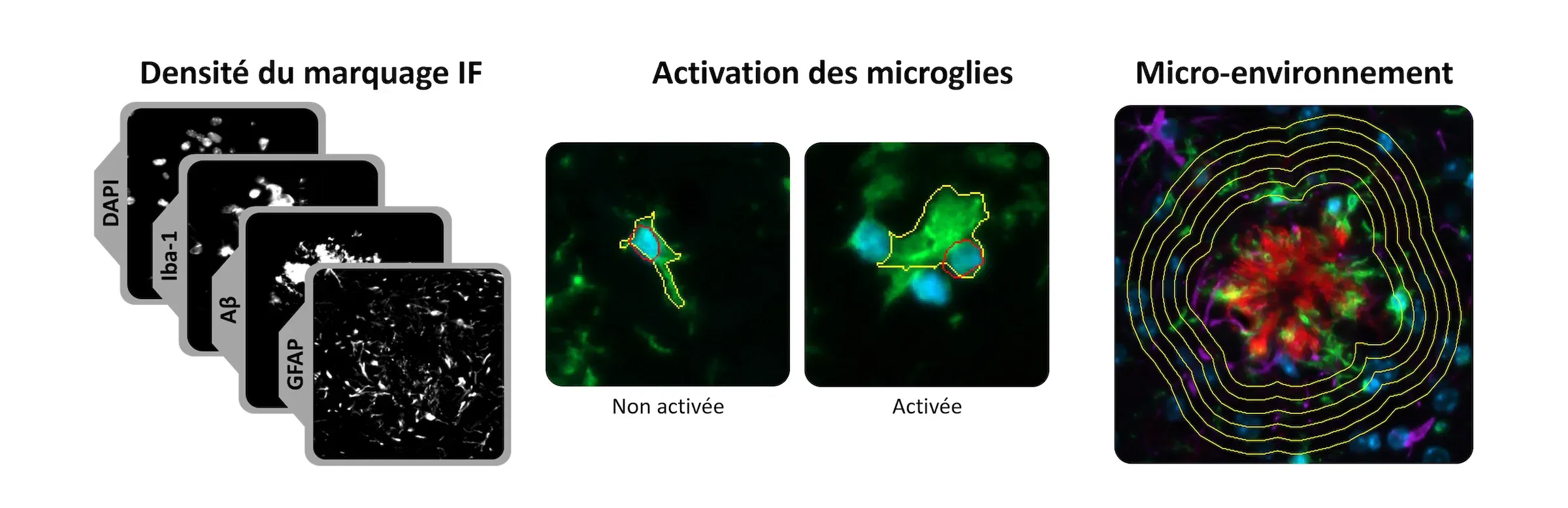 Composé de trois images microscopiques ou scanners différents, chacun illustrant un aspect différent de l'analyse des tissus biologiques, potentiellement dans le contexte de la neurobiologie.