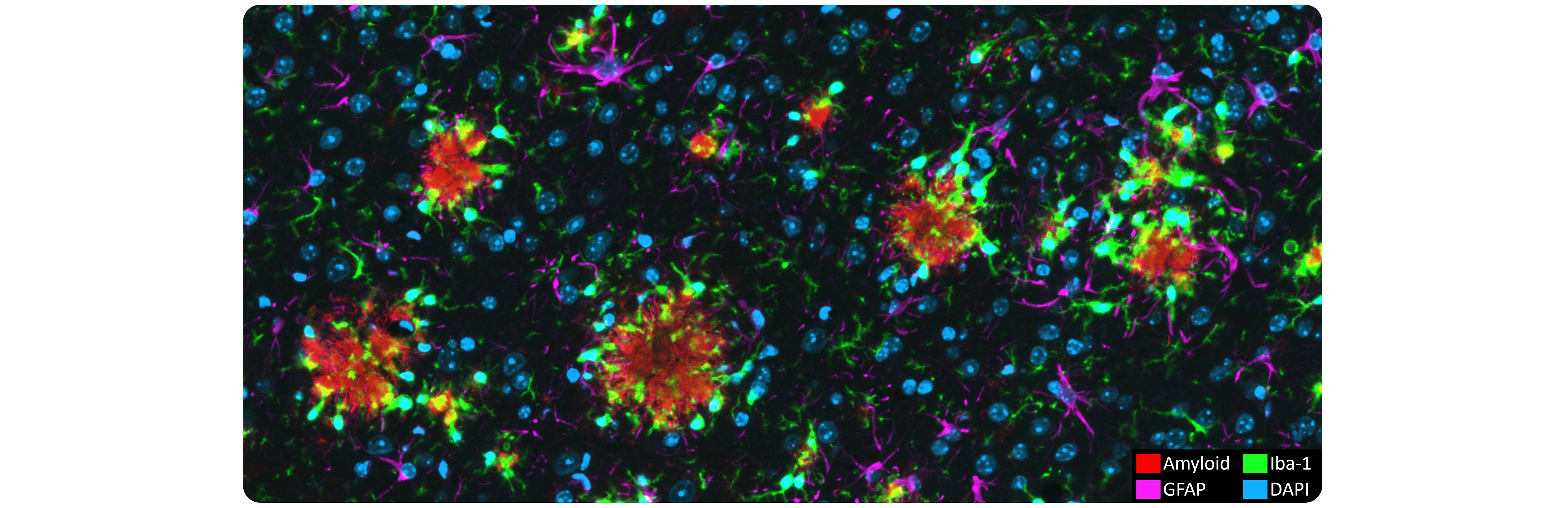 Multiplexed Immunofluorescence (IF) - Histology & Tissue Analysis ...