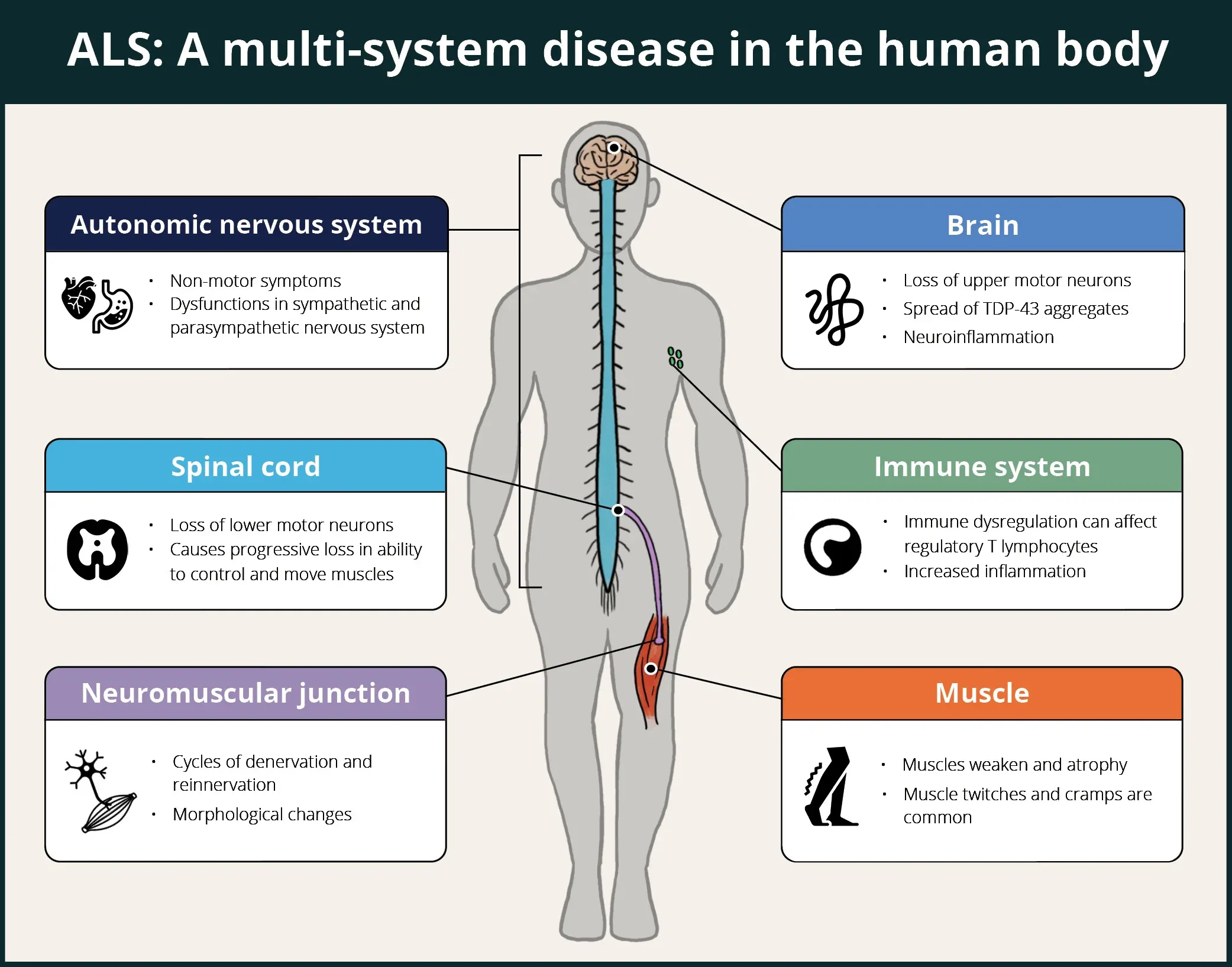 Effets multisystèmes de la SLA sur le corps humain