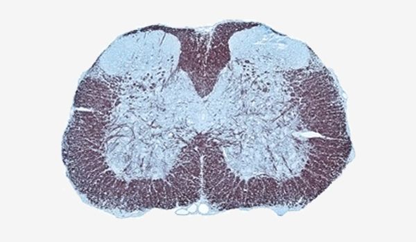 Histological section, which is often used in the study of Experimental Autoimmune Encephalomyelitis (EAE) models