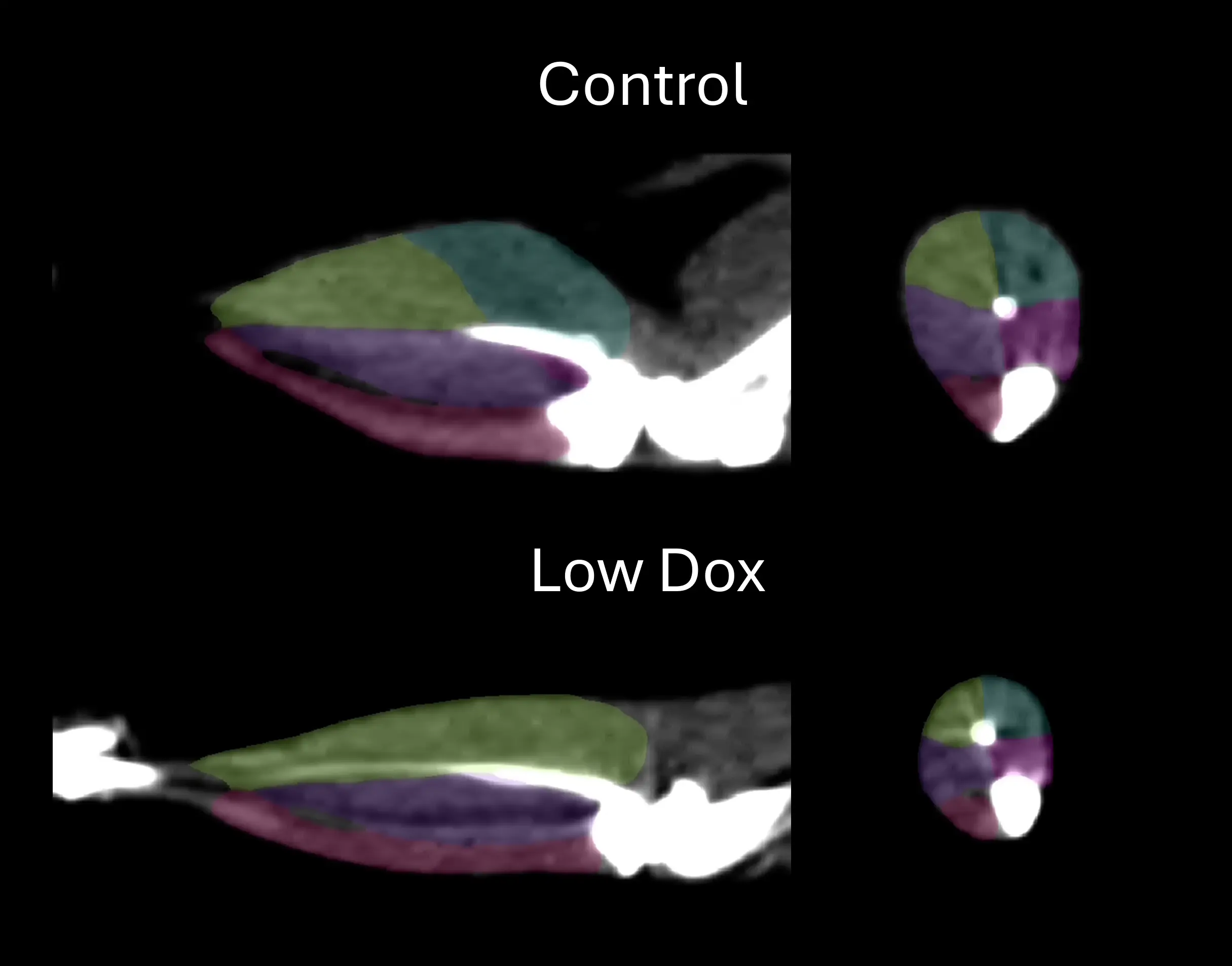 Image tomodensitométrique avec segmentation des muscles des membres postérieurs de souris témoins (sous dox) et de souris à faible dose de dox.