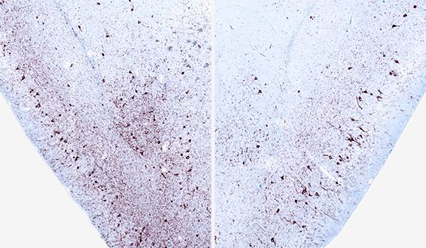 A pair of brain tissue sections processed with immunohistochemistry (IHC) to highlight phosphorylated alpha-synuclein, which is relevant in the context of Parkinson's Disease research