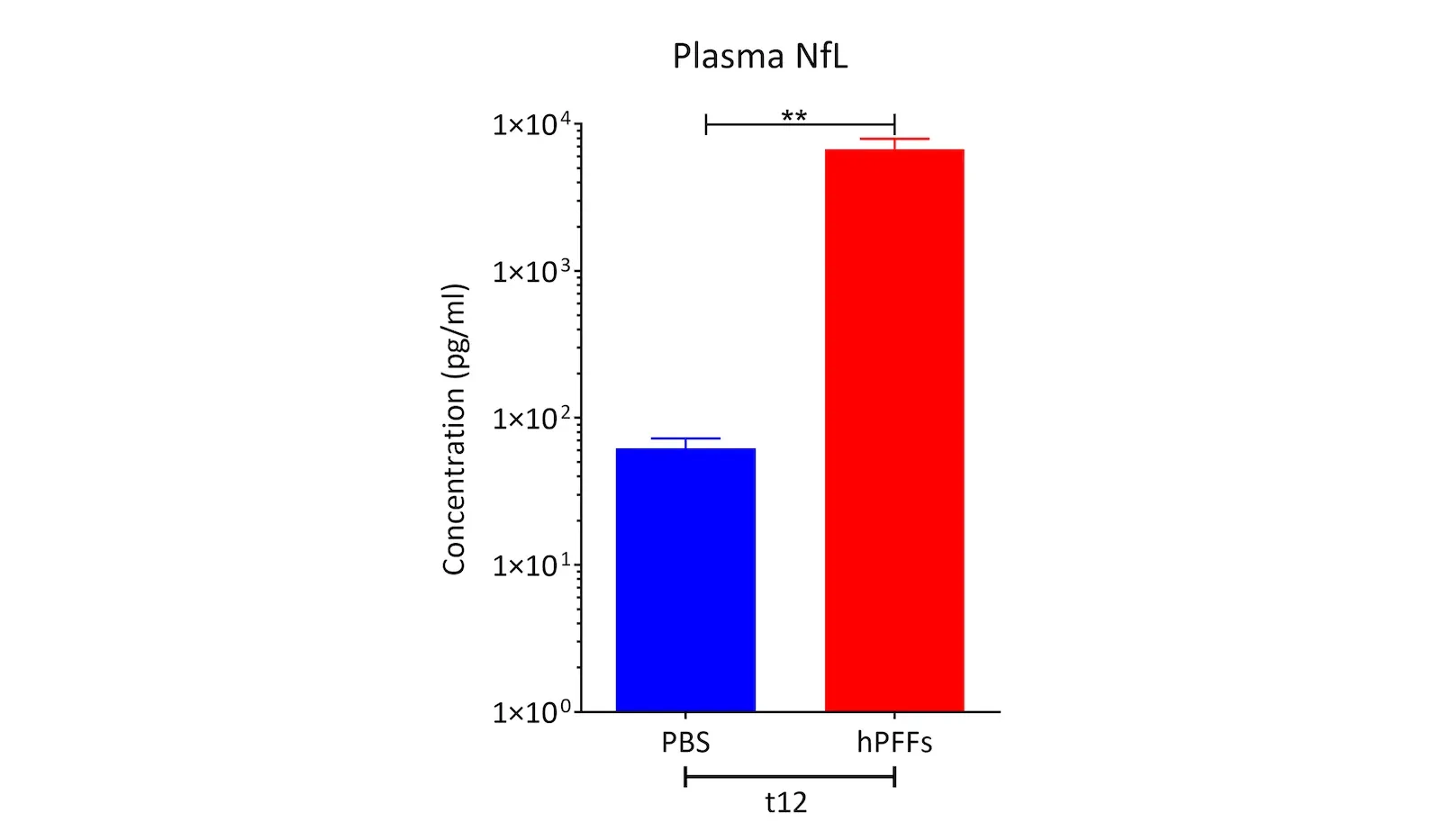 Striatum Ctx NFL Plasma Graph