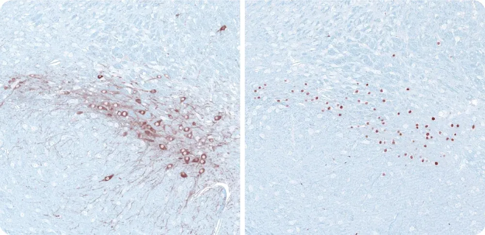 Immunohistochemistry (IHC) staining of the mouse substantia nigra